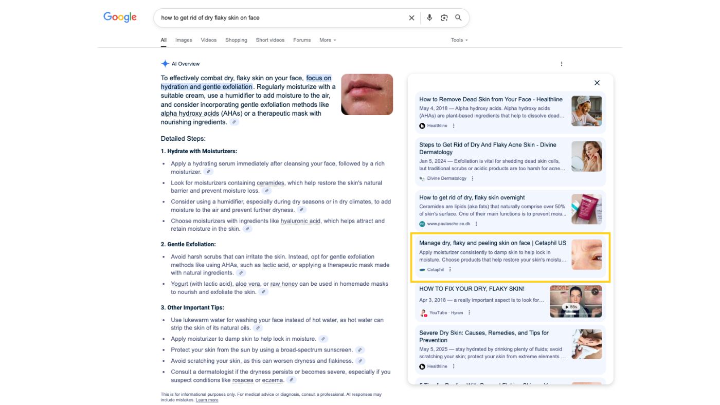 Screen capture of a google search for "how to get rid of dry flaky skin on face" featuring a Cetaphil article in AI suggestions.